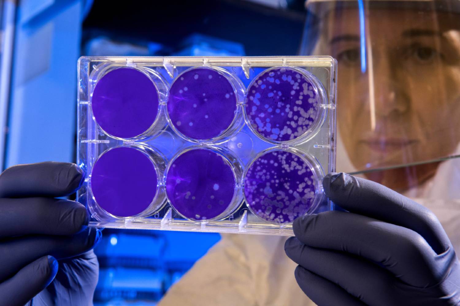 Scientist looking at bacteria in petri dish